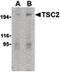 TSC Complex Subunit 2 antibody, PA5-20133, Invitrogen Antibodies, Western Blot image 