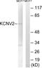Potassium Voltage-Gated Channel Modifier Subfamily V Member 2 antibody, GTX87208, GeneTex, Western Blot image 
