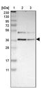 UDP-Galactose-4-Epimerase antibody, PA5-52423, Invitrogen Antibodies, Western Blot image 