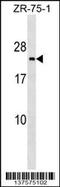 Transmembrane P24 Trafficking Protein 3 antibody, 59-247, ProSci, Western Blot image 