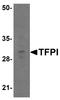 Tissue Factor Pathway Inhibitor antibody, A01052-1, Boster Biological Technology, Western Blot image 