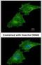 Coronin 1C antibody, PA5-30479, Invitrogen Antibodies, Immunofluorescence image 