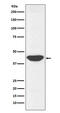 Isocitrate Dehydrogenase (NADP(+)) 1, Cytosolic antibody, M00129-2, Boster Biological Technology, Western Blot image 