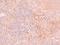 Jumonji Domain Containing 4 antibody, A16245, Boster Biological Technology, Immunohistochemistry paraffin image 