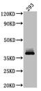 Dickkopf WNT Signaling Pathway Inhibitor 1 antibody, CSB-RA576260A0HU, Cusabio, Western Blot image 