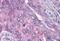 Polo Like Kinase 1 antibody, MBS240428, MyBioSource, Immunohistochemistry paraffin image 