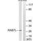 RAB29, Member RAS Oncogene Family antibody, PA5-50109, Invitrogen Antibodies, Western Blot image 