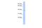 Sirtuin 4 antibody, NBP1-80002, Novus Biologicals, Western Blot image 