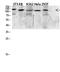 Epidermal Growth Factor antibody, STJ98714, St John