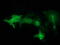 Sorting Nexin 8 antibody, TA502135, Origene, Immunofluorescence image 