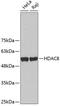 Histone Deacetylase 8 antibody, 18-604, ProSci, Western Blot image 