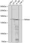 Transient receptor potential cation channel subfamily M member 4 antibody, 13-460, ProSci, Western Blot image 