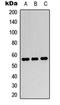 Peroxisome Proliferator Activated Receptor Gamma antibody, orb315656, Biorbyt, Western Blot image 