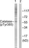 Catalase antibody, PA5-38439, Invitrogen Antibodies, Western Blot image 