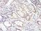 SMAD Family Member 4 antibody, MA5-15682, Invitrogen Antibodies, Immunohistochemistry paraffin image 