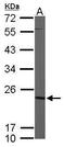 Cytidine/Uridine Monophosphate Kinase 1 antibody, GTX105566, GeneTex, Western Blot image 