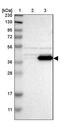 Branched Chain Keto Acid Dehydrogenase Kinase antibody, PA5-53697, Invitrogen Antibodies, Western Blot image 
