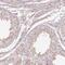 RB1 Inducible Coiled-Coil 1 antibody, NBP2-47312, Novus Biologicals, Immunohistochemistry paraffin image 
