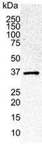 Cyclin Dependent Kinase 6 antibody, GTX75692, GeneTex, Western Blot image 