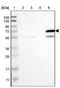 Cytochrome P450 Family 4 Subfamily F Member 11 antibody, PA5-53570, Invitrogen Antibodies, Western Blot image 