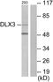 Homeobox protein DLX-3 antibody, LS-C118694, Lifespan Biosciences, Western Blot image 