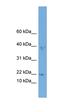 Actin Related Protein 2/3 Complex Subunit 3 antibody, orb330660, Biorbyt, Western Blot image 