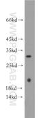 Indolethylamine N-Methyltransferase antibody, 21578-1-AP, Proteintech Group, Western Blot image 