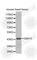 G Protein Subunit Alpha 15 antibody, A2080, ABclonal Technology, Western Blot image 