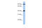 PTOV1 Extended AT-Hook Containing Adaptor Protein antibody, 26-553, ProSci, Western Blot image 