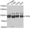 Threonyl-TRNA Synthetase antibody, A6993, ABclonal Technology, Western Blot image 