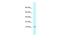 NADH:Ubiquinone Oxidoreductase Subunit A6 antibody, PA5-70572, Invitrogen Antibodies, Western Blot image 