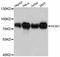 RIO Kinase 2 antibody, A12122, ABclonal Technology, Western Blot image 