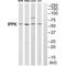 Inositol-Pentakisphosphate 2-Kinase antibody, MBS9413273, MyBioSource, Western Blot image 