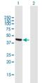 Alcohol Dehydrogenase Iron Containing 1 antibody, H00137872-B01P, Novus Biologicals, Western Blot image 