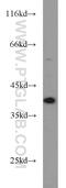 DNA Polymerase Beta antibody, 18003-1-AP, Proteintech Group, Western Blot image 