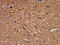 Fragile Histidine Triad Diadenosine Triphosphatase antibody, LS-C211983, Lifespan Biosciences, Immunohistochemistry paraffin image 