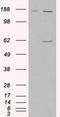 Monoamine Oxidase A antibody, NB100-2417, Novus Biologicals, Western Blot image 