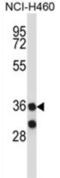  antibody, abx027622, Abbexa, Western Blot image 