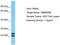 Transmembrane Protein 39B antibody, TA330778, Origene, Western Blot image 