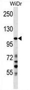 Sushi Domain Containing 2 antibody, AP54112PU-N, Origene, Western Blot image 