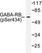 Gamma-Aminobutyric Acid Type A Receptor Beta1 Subunit antibody, LS-C192162, Lifespan Biosciences, Western Blot image 