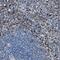 Fibroleukin antibody, NBP1-87198, Novus Biologicals, Immunohistochemistry paraffin image 