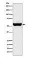 Monoamine Oxidase B antibody, M02126-1, Boster Biological Technology, Western Blot image 