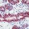 O-6-Methylguanine-DNA Methyltransferase antibody, MA5-13506, Invitrogen Antibodies, Immunohistochemistry frozen image 
