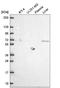 MTSS I-BAR Domain Containing 1 antibody, NBP2-58013, Novus Biologicals, Western Blot image 