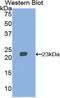 3-Hydroxy-3-Methylglutaryl-CoA Synthase 1 antibody, LS-C294547, Lifespan Biosciences, Western Blot image 