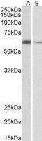 Ariadne RBR E3 Ubiquitin Protein Ligase 2 antibody, GTX89734, GeneTex, Western Blot image 