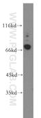 Cartilage Acidic Protein 1 antibody, 13001-1-AP, Proteintech Group, Western Blot image 