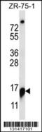 Ribonuclease P And MRP Subunit P25 antibody, 56-856, ProSci, Western Blot image 