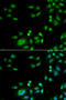 Integrator Complex Subunit 10 antibody, STJ28715, St John